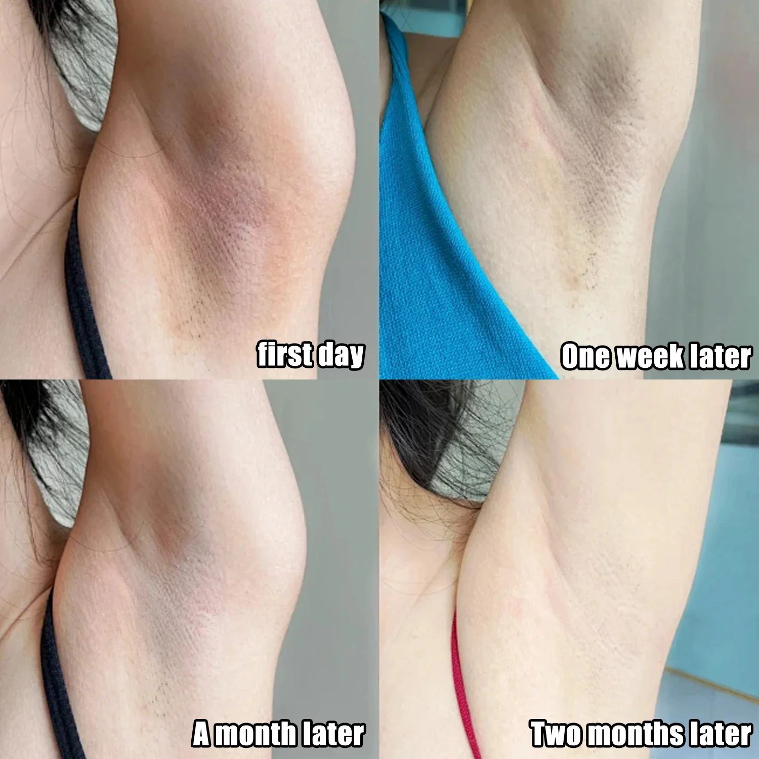 Collagen Underarm Whitening Cr - Skincare Collagen ulasan dan harga