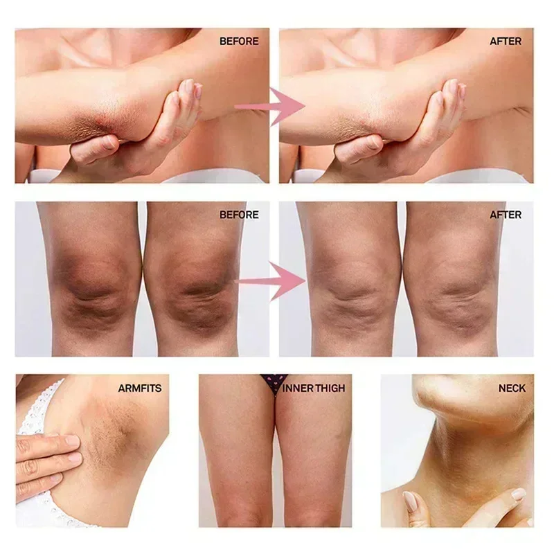 Collagen Underarm Whitening Cr - Skincare Collagen ulasan dan harga