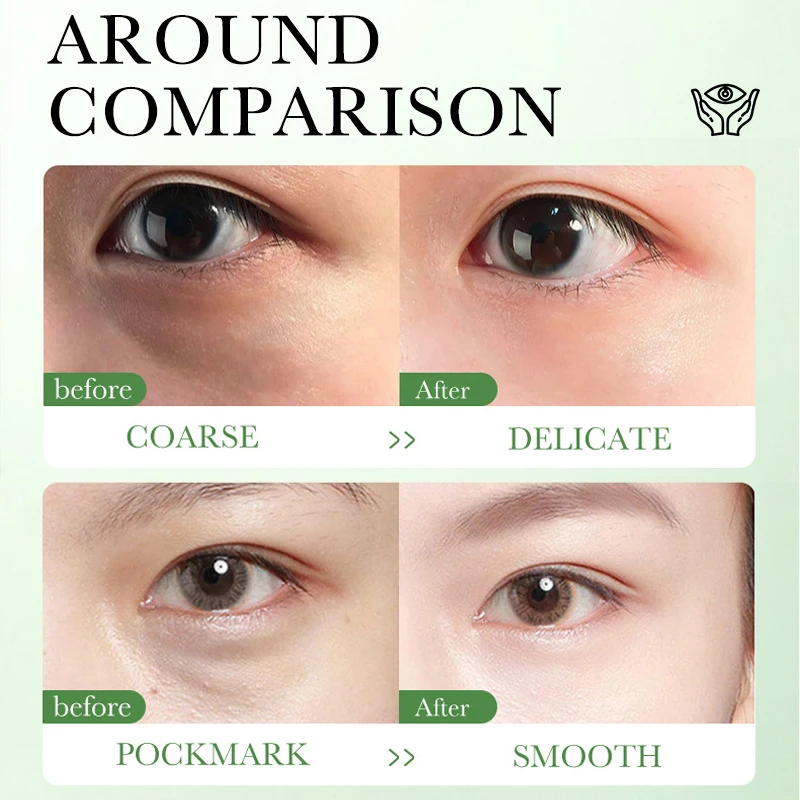 Centella Asiatica Eye Cream Mo - Centella Asiatica Toner ulasan dan harga