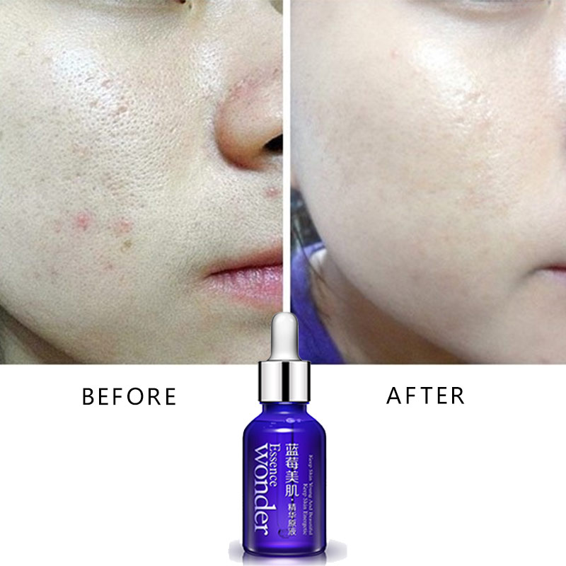 BIOAQUA Blueberry Face Lifting - Skincare Garnier ulasan dan harga