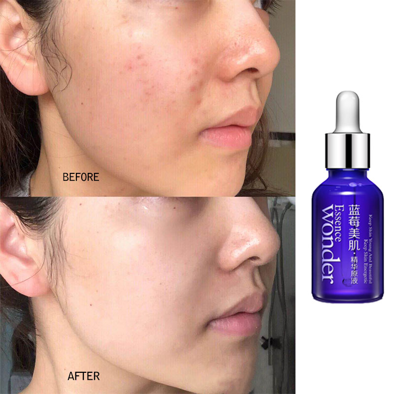 BIOAQUA Blueberry Face Lifting - Skincare Garnier ulasan dan harga