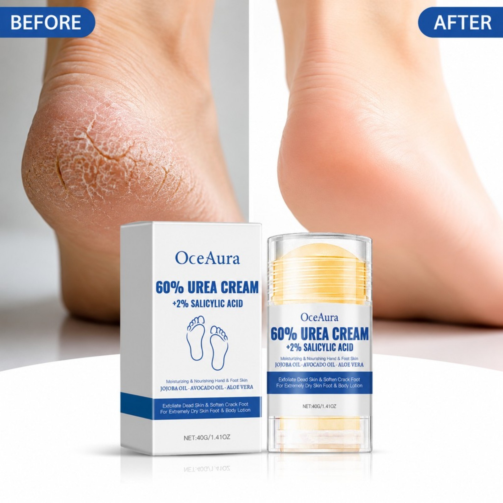 60% Urea Foot Care Cream Stick - Urea Foot Cream ulasan dan harga