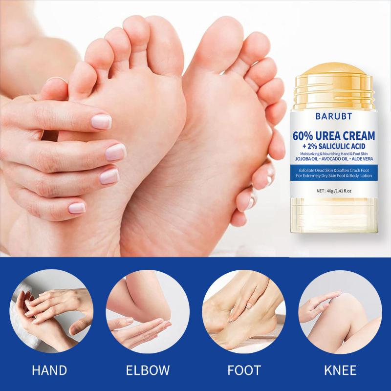 Urea Foot & Hand Cream with 2% - Urea Foot Cream ulasan dan harga