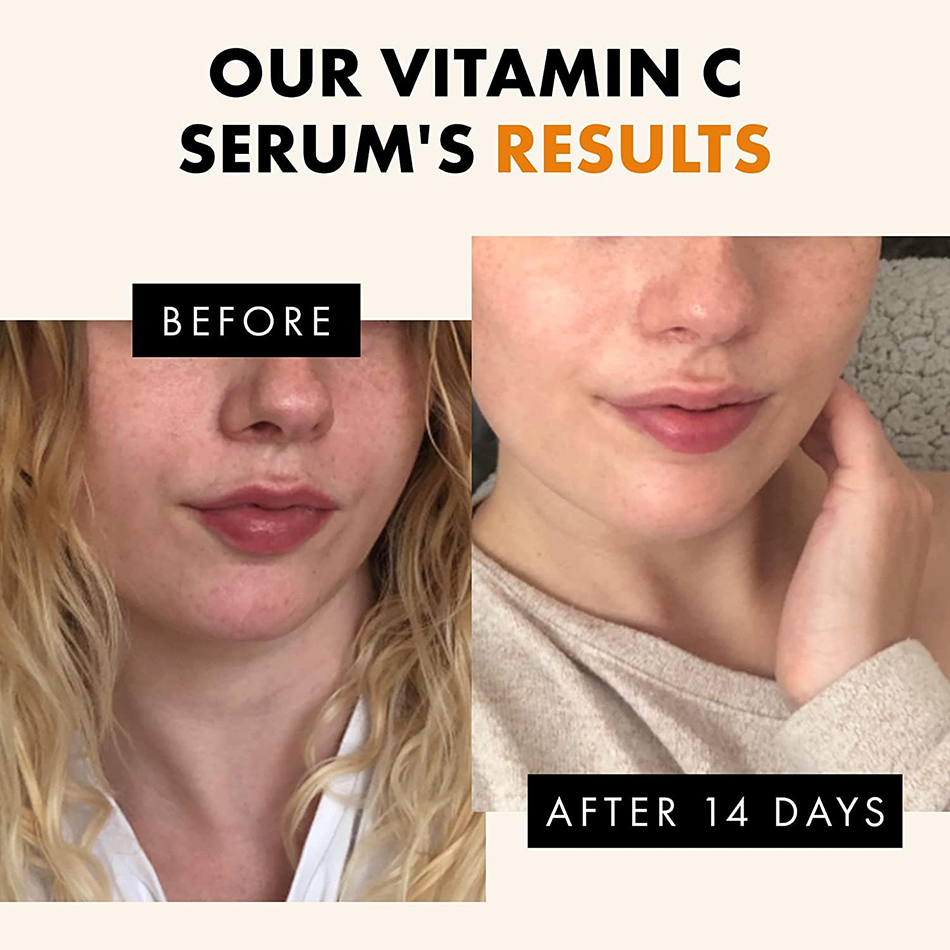 120ml 99% Vitamin C Serum Oil  - Skincare Garnier ulasan dan harga
