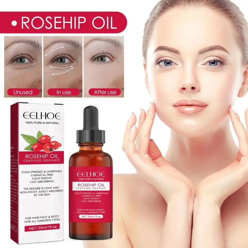 30ml Organic Rosehip Seed Oil  - Face Oil Rosehip ulasan dan harga