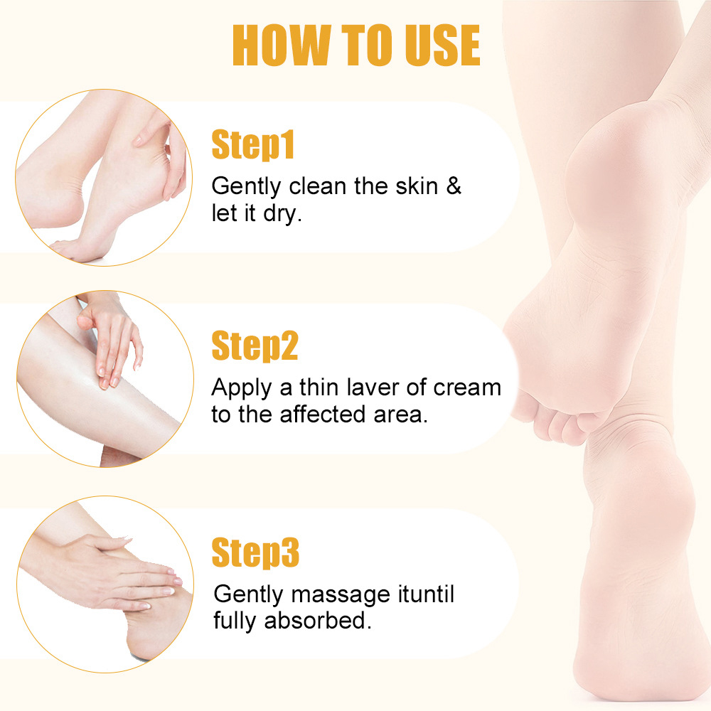 Urea Cream 60% Salicylic Acid  - Urea Foot Cream ulasan dan harga