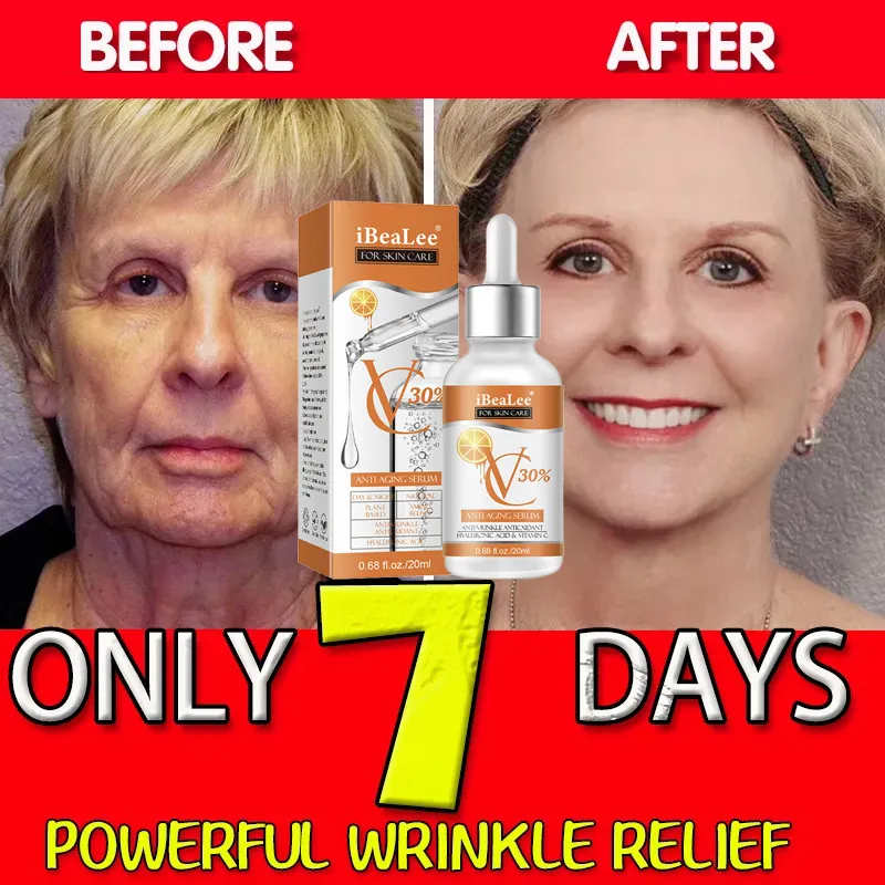 Premium 30% Vitamin C Serum Fo - Skincare Garnier ulasan dan harga