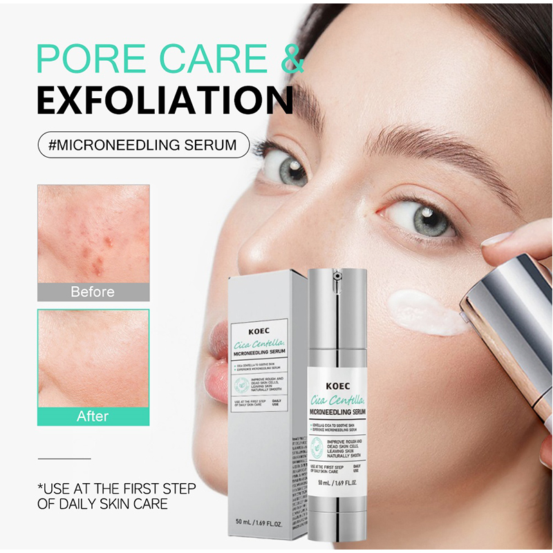 Soothing Microneedle Serum, Ce - Centella Asiatica Toner ulasan dan harga